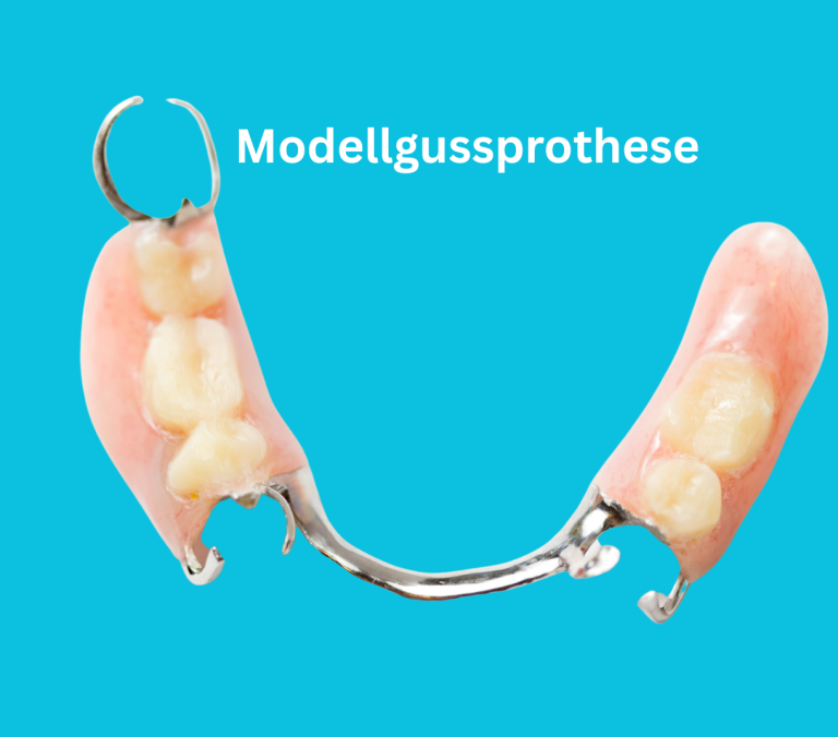 Modellgussprothese Zahnarzt Regensburg