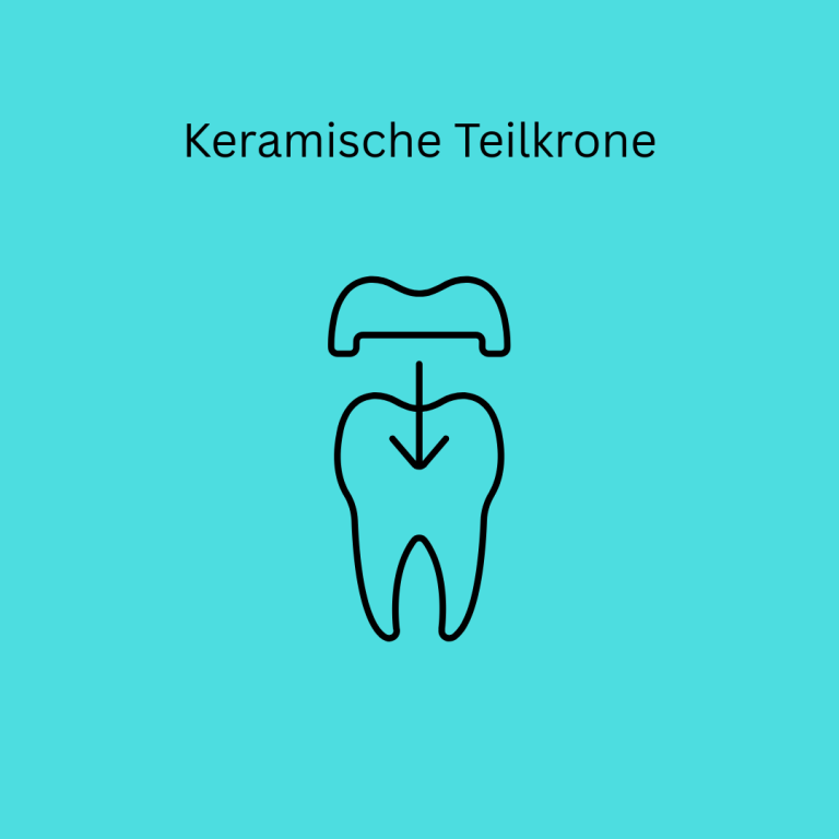 Keramische Teilkrone Regensburg